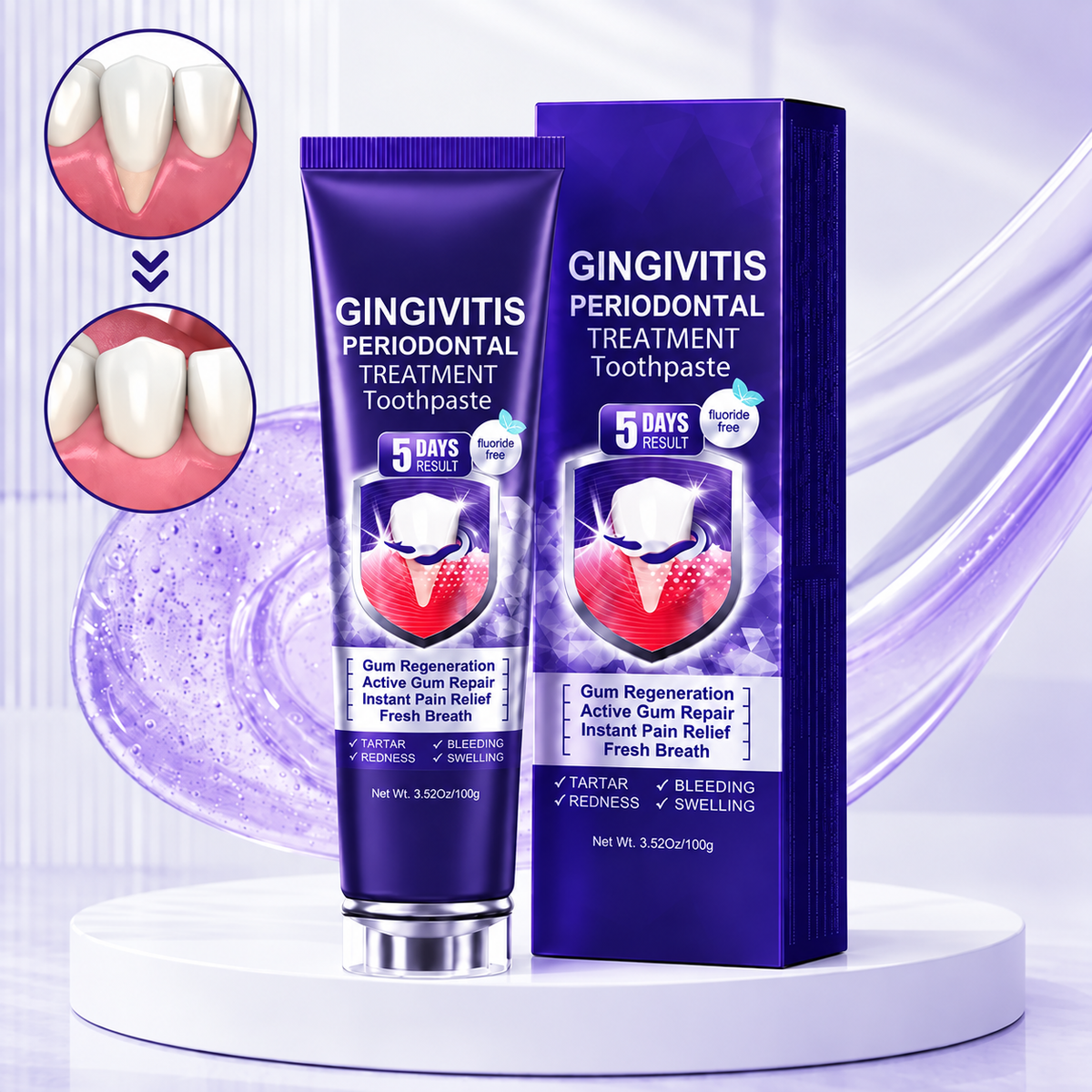 Gingivitis Periodontal Treatment Toothpaste